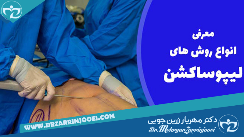 بهترین پزشک پوست در اصفهان | بلفاروپلاستی اصفهان